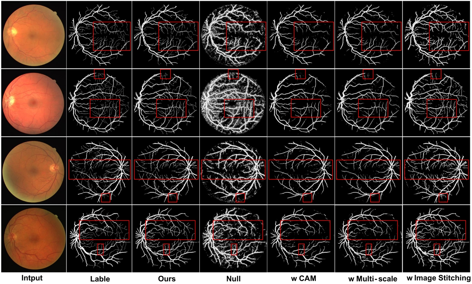 Retinal Vessel Segmentation Journal